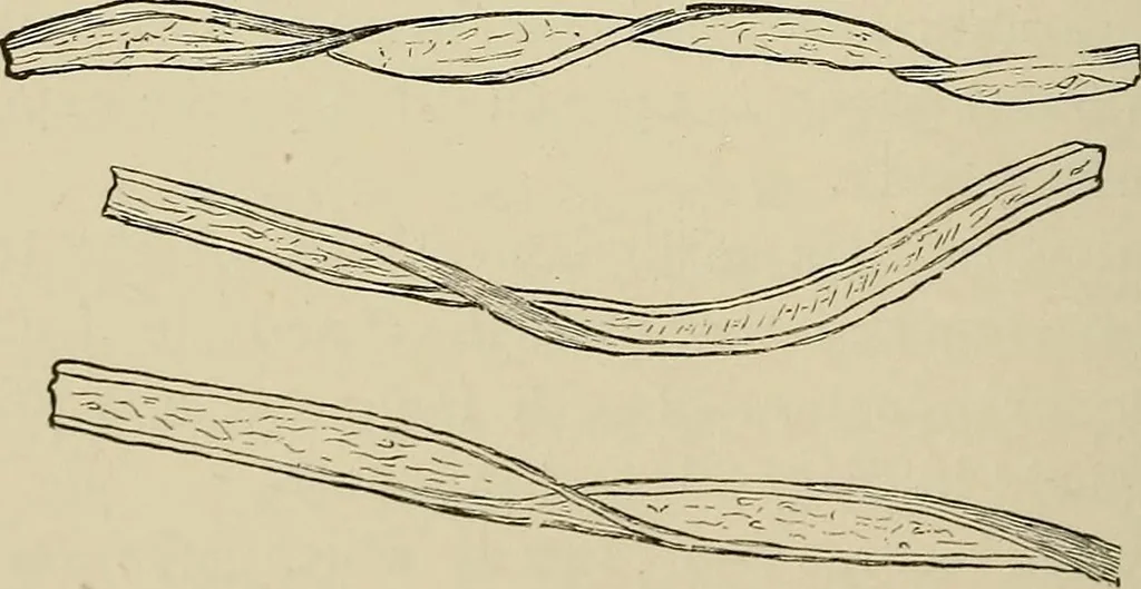 An illustration from Medical microscopy : a guide to the use of the microscope in medical practice, 1898, leaf 293
