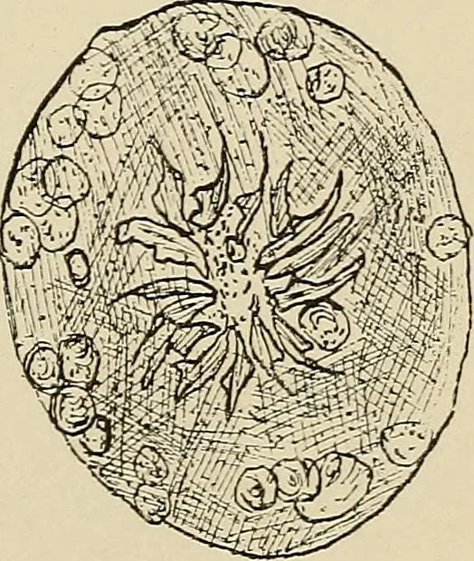 An illustration from Medical microscopy : a guide to the use of the microscope in medical practice, 1898, leaf 324