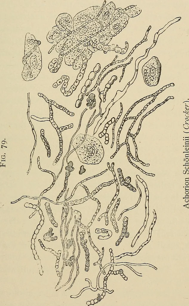 An illustration from Medical microscopy : a guide to the use of the microscope in medical practice, 1898, leaf 366