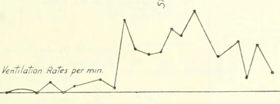 An illustration from The medical problems of flying, including reports nos. 1-7 of the Air medical investigation committee, 1920, leaf 49