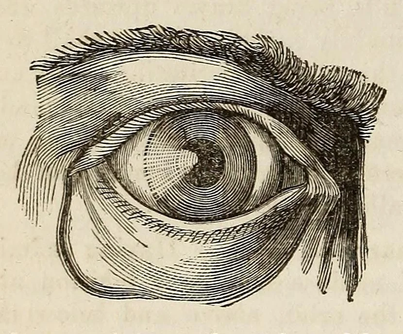An illustration from The Medical and surgical reporter, 1858, leaf 108