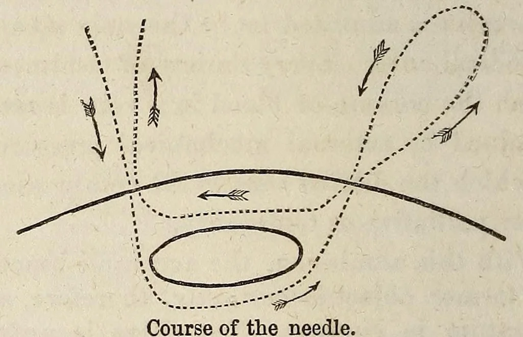 An illustration from The Medical and surgical reporter, 1858, leaf 184