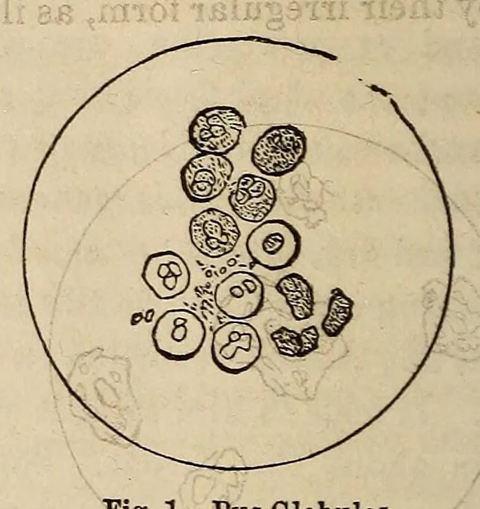 An illustration from The Medical and surgical reporter, 1858, leaf 584