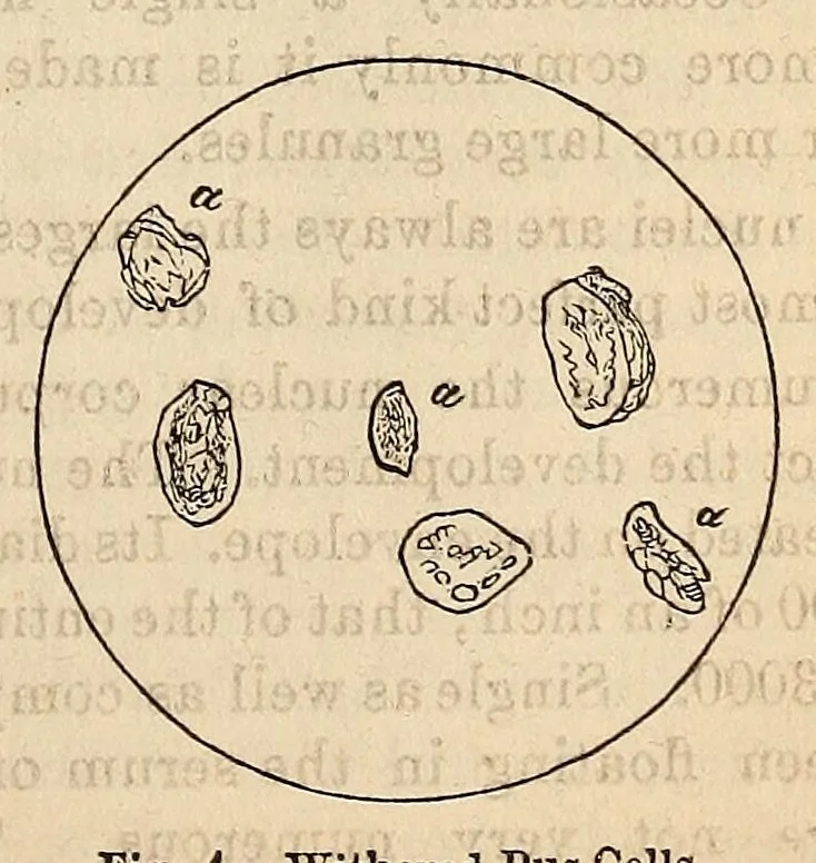 An illustration from The Medical and surgical reporter, 1858, leaf 585