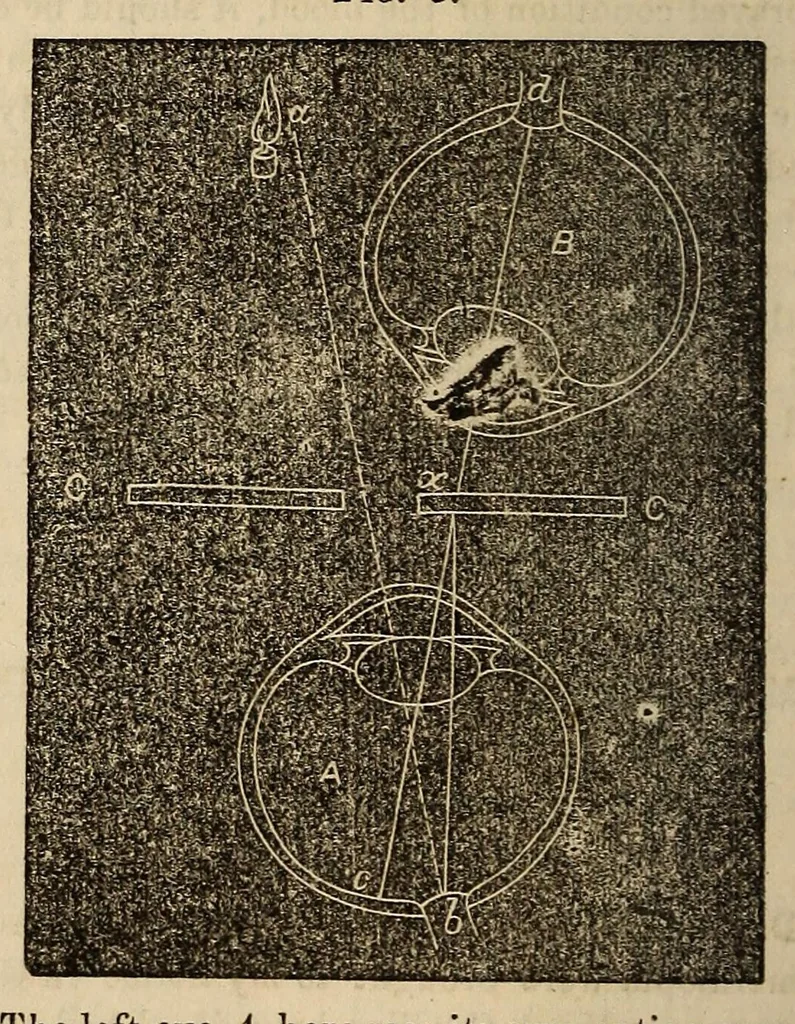 An illustration from The Medical and surgical reporter, 1858, leaf 316