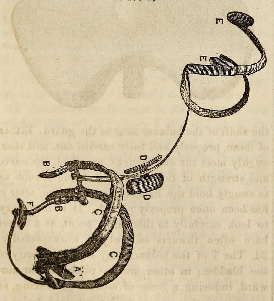 An illustration from The Medical and surgical reporter, 1858, leaf 396