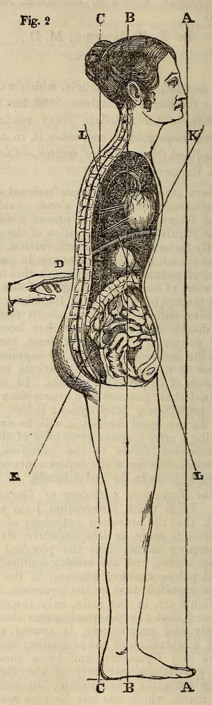 An illustration from The Medical and surgical reporter, 1858, leaf 580