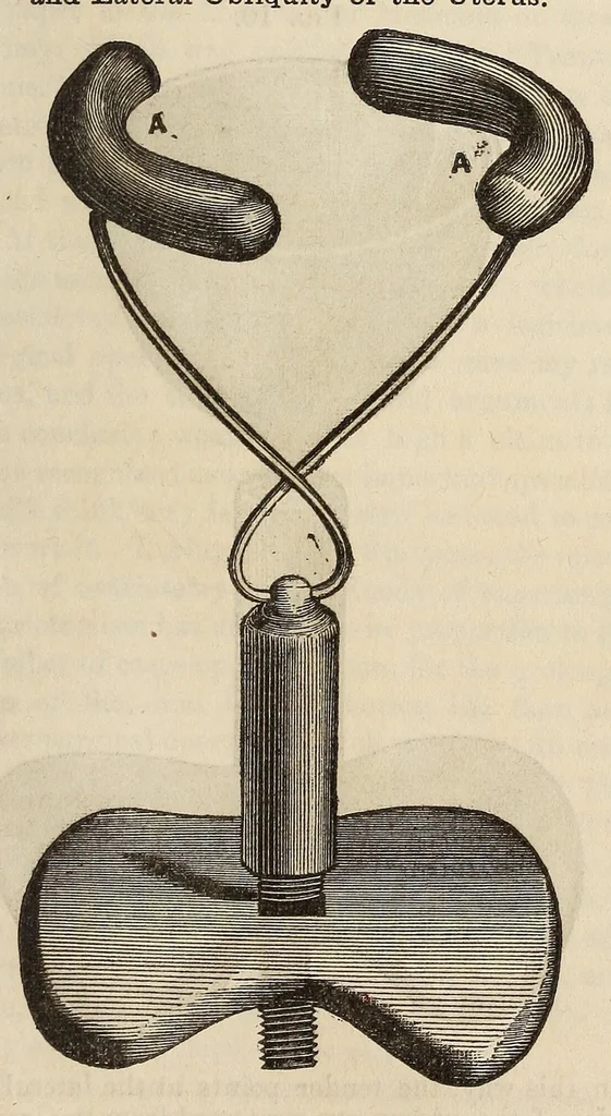 An illustration from The Medical and surgical reporter, 1858, leaf 585