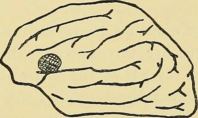 An illustration from Medicine and the mind : (la medecine de l'esprit), 1900, leaf 178
