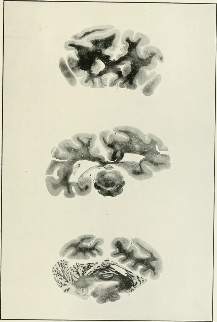 An illustration from Memoirs, 1783, leaf 150
