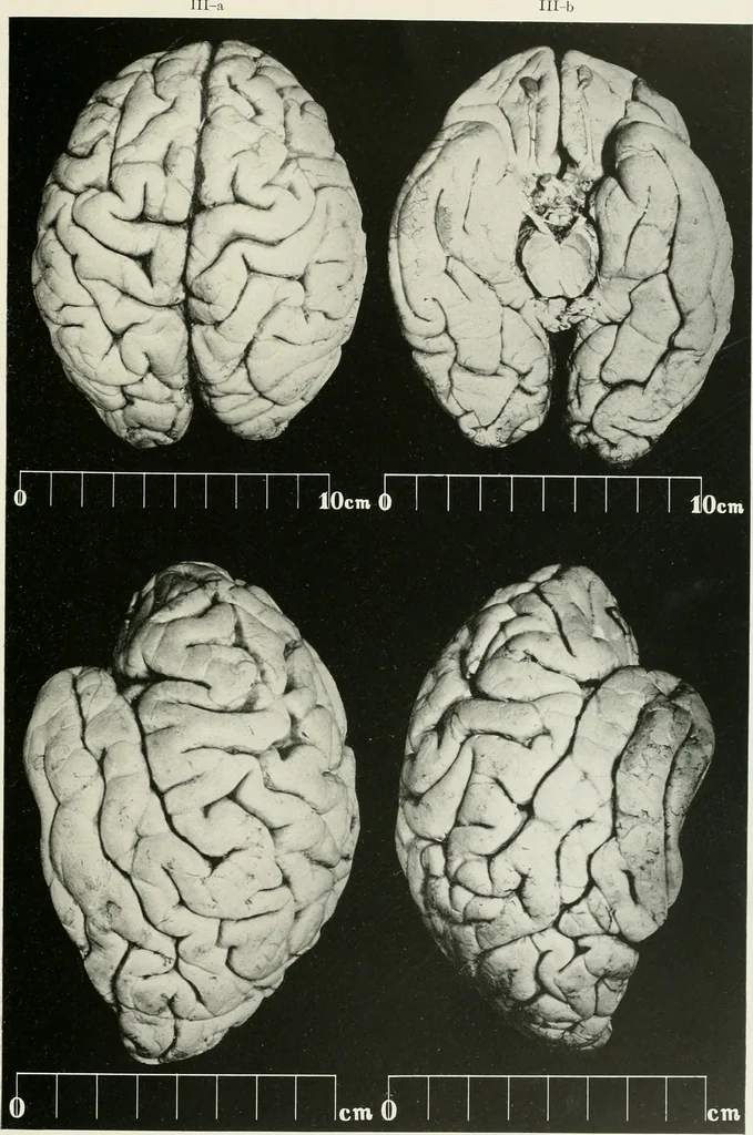 An illustration from Memoirs, 1783, leaf 156