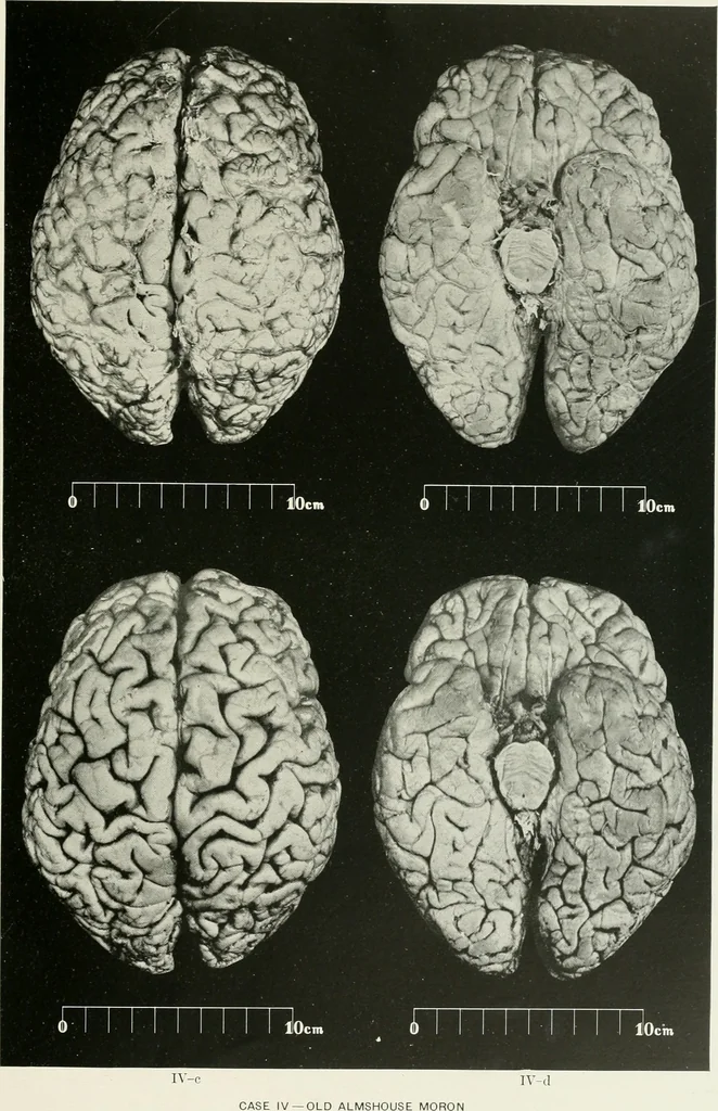 An illustration from Memoirs, 1783, leaf 158