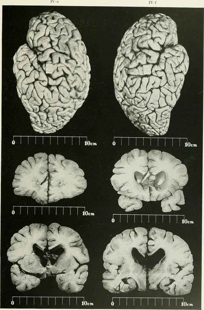 An illustration from Memoirs, 1783, leaf 160