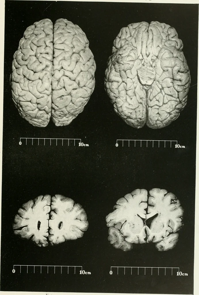 An illustration from Memoirs, 1783, leaf 162