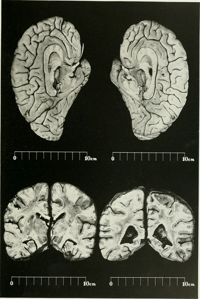 An illustration from Memoirs, 1783, leaf 172