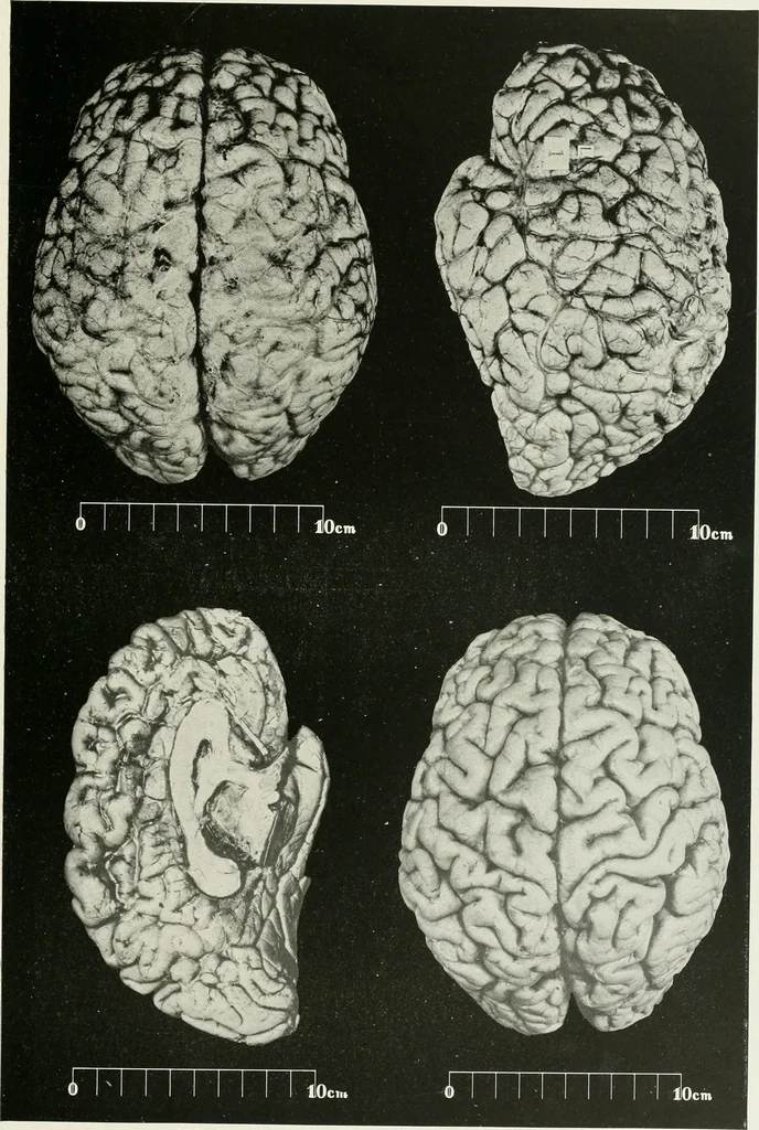 An illustration from Memoirs, 1783, leaf 174