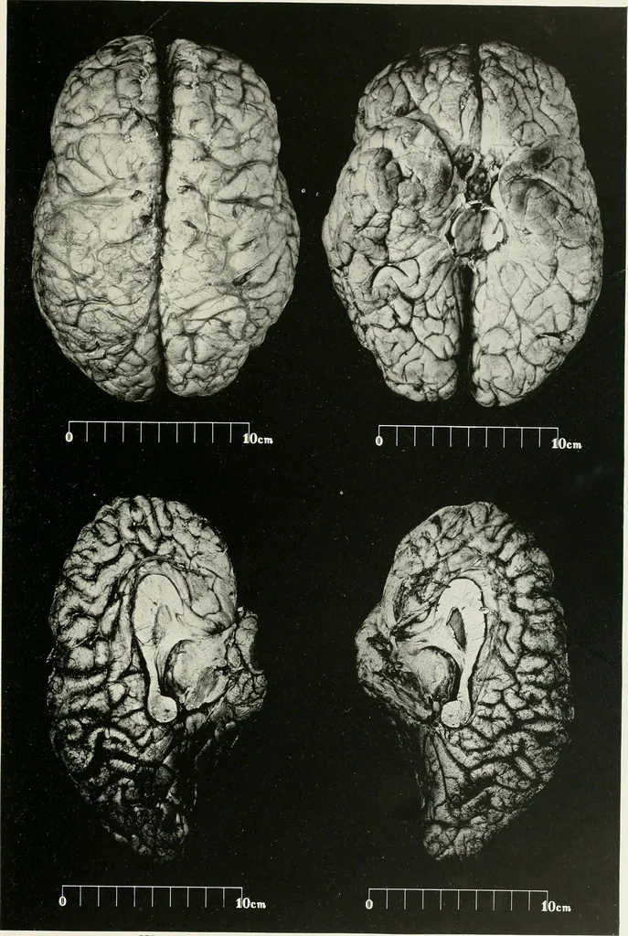 An illustration from Memoirs, 1783, leaf 178