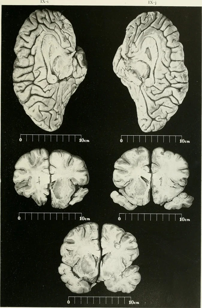 An illustration from Memoirs, 1783, leaf 182