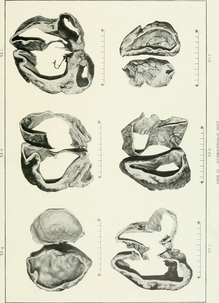 An illustration from Memoirs, 1783, leaf 274