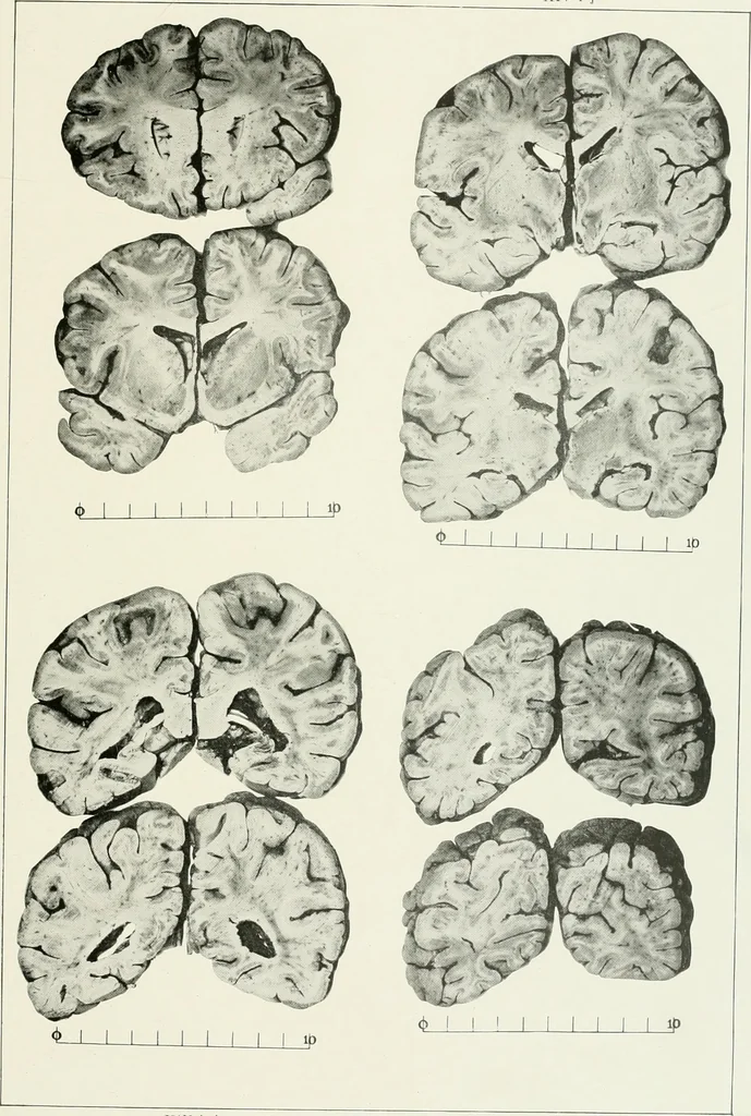 An illustration from Memoirs, 1783, leaf 290