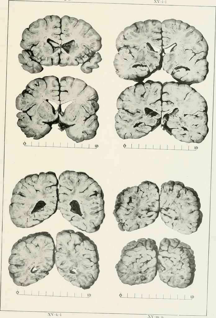 An illustration from Memoirs, 1783, leaf 296