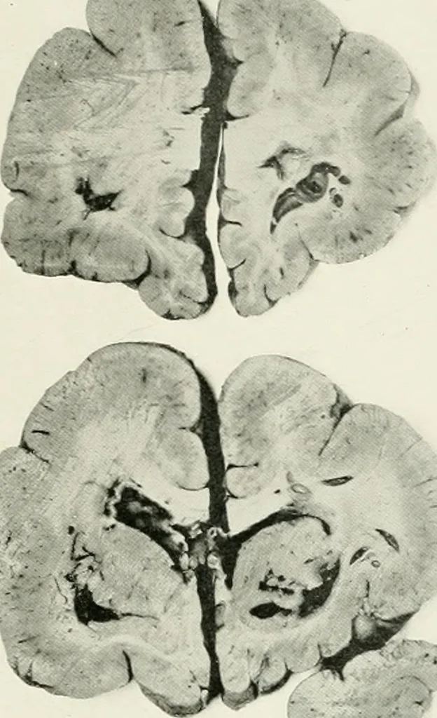 An illustration from Memoirs, 1783, leaf 302