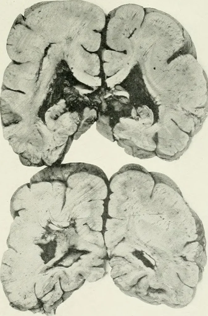 An illustration from Memoirs, 1783, leaf 302
