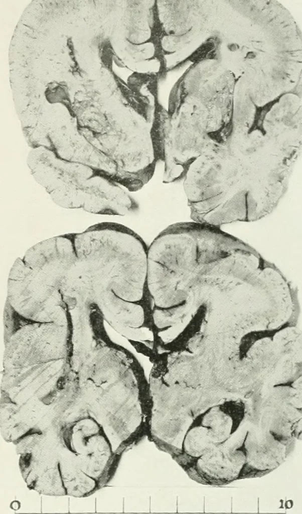 An illustration from Memoirs, 1783, leaf 302