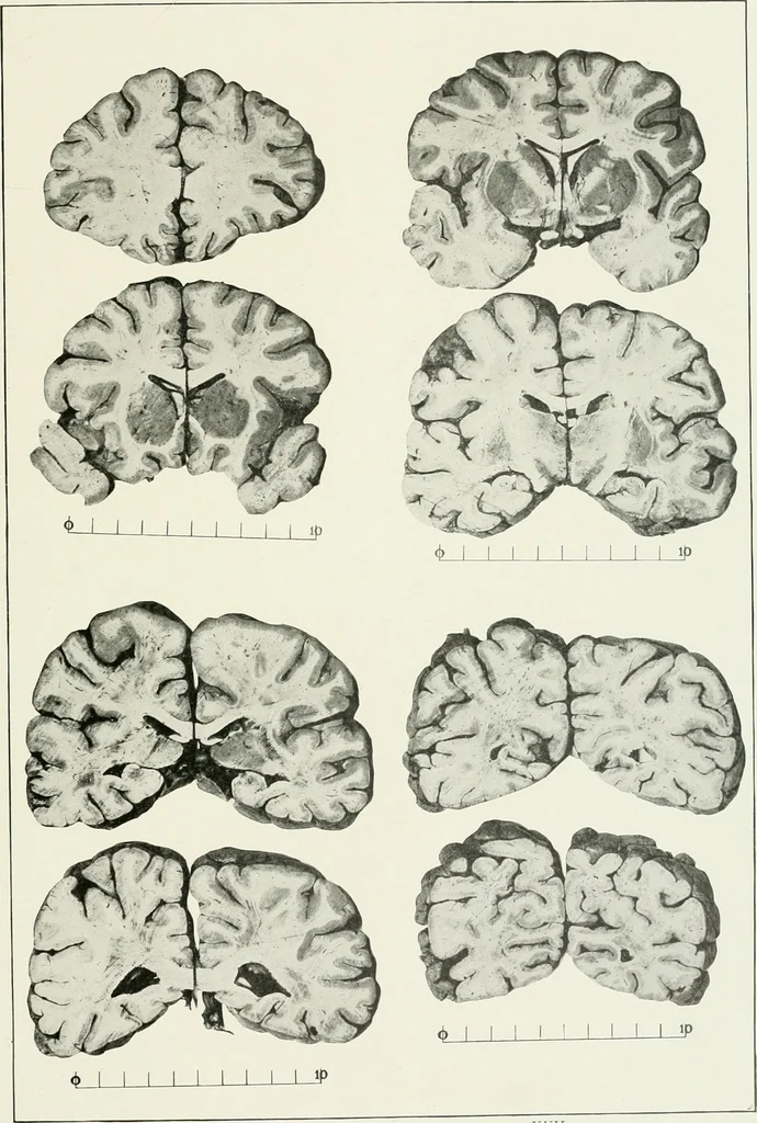 An illustration from Memoirs, 1783, leaf 306