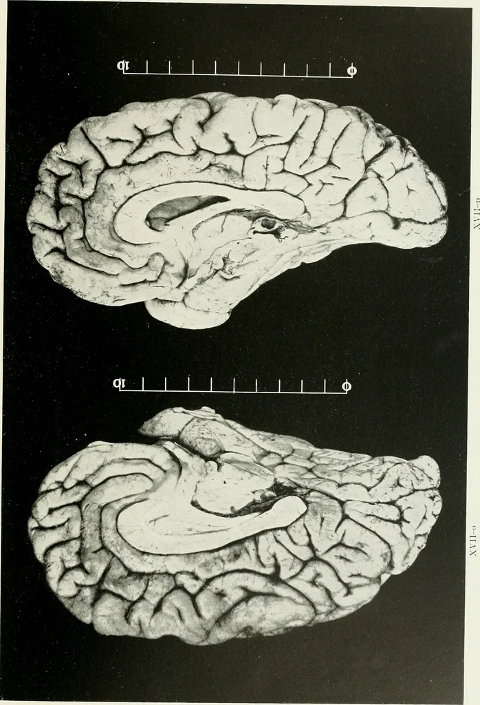 An illustration from Memoirs, 1783, leaf 308