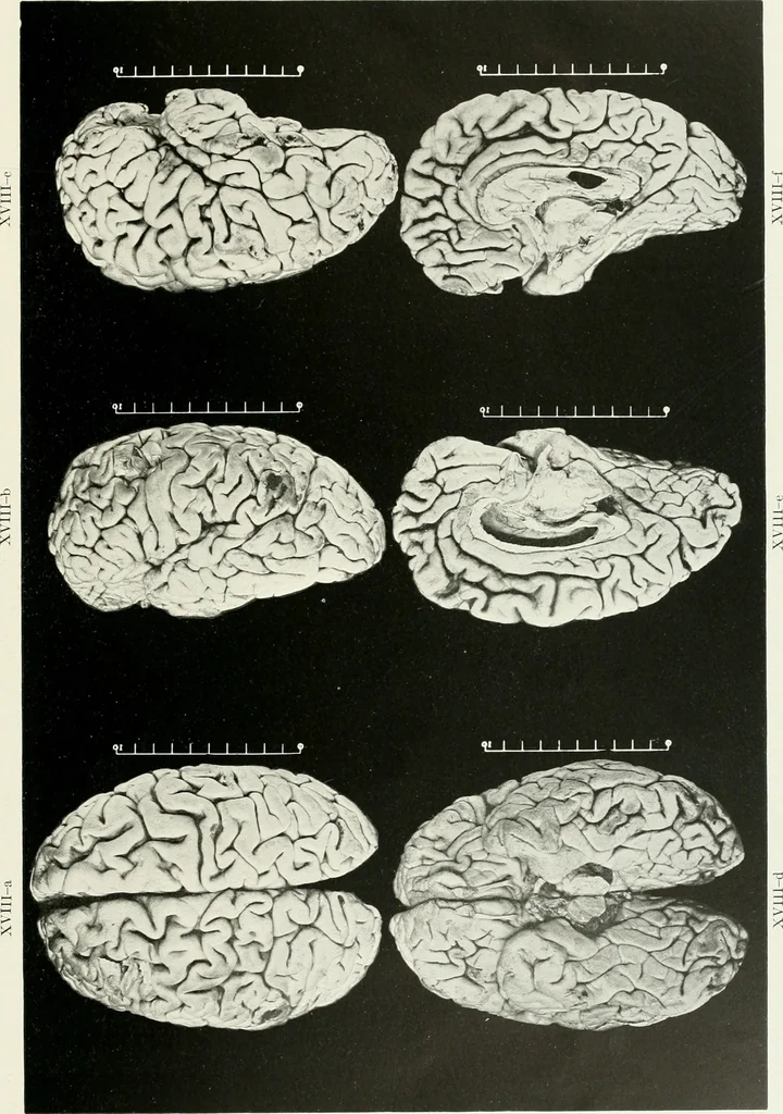 An illustration from Memoirs, 1783, leaf 310