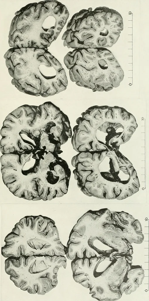 An illustration from Memoirs, 1783, leaf 312