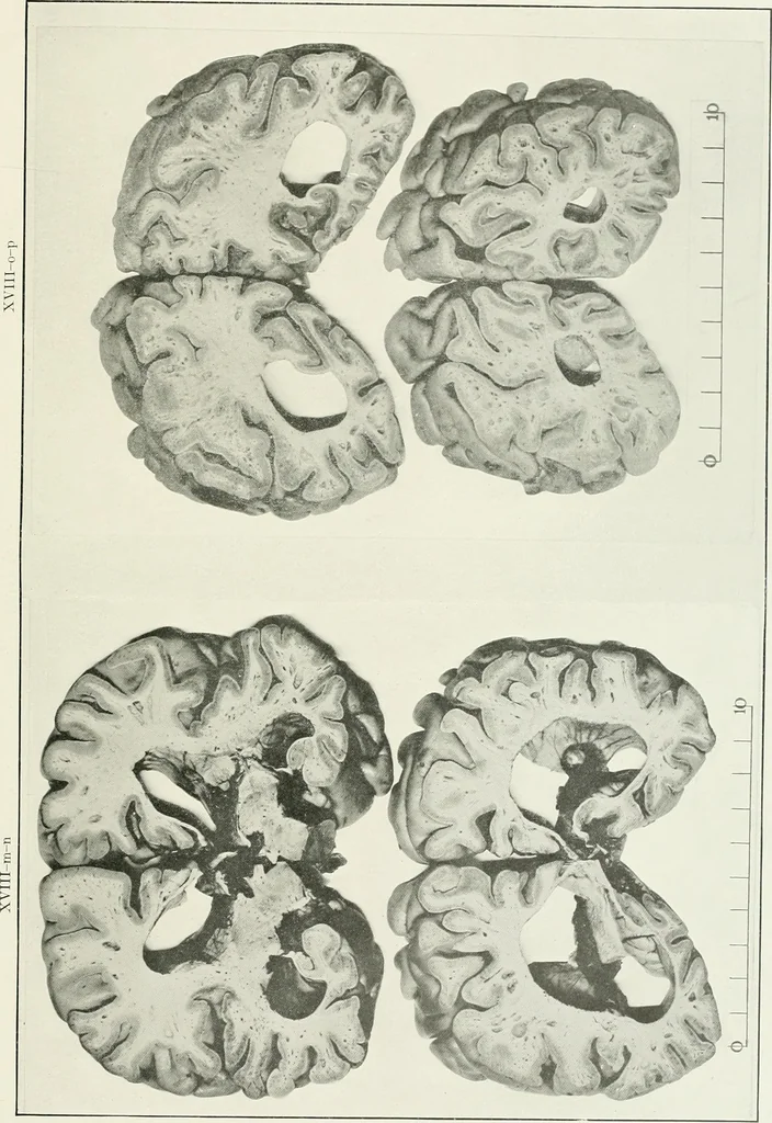 An illustration from Memoirs, 1783, leaf 314