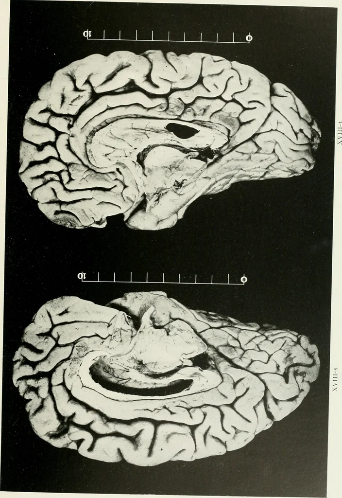 An illustration from Memoirs, 1783, leaf 318