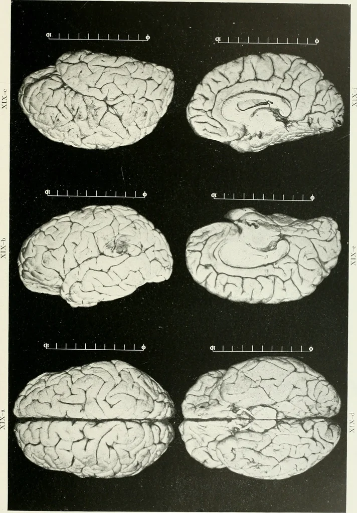 An illustration from Memoirs, 1783, leaf 322