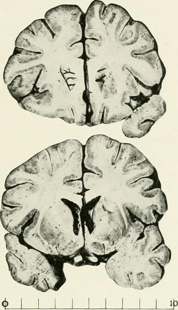 An illustration from Memoirs, 1783, leaf 326
