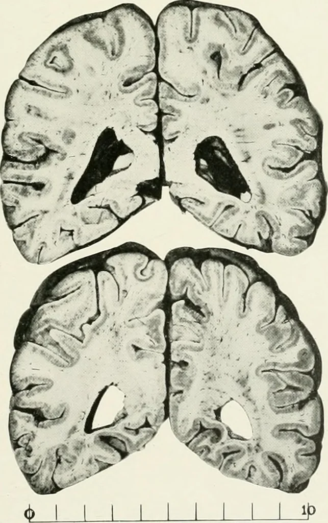 An illustration from Memoirs, 1783, leaf 326