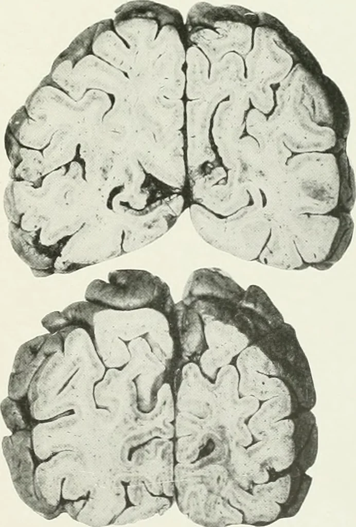 An illustration from Memoirs, 1783, leaf 326