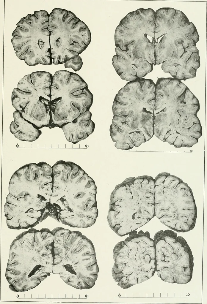 An illustration from Memoirs, 1783, leaf 332