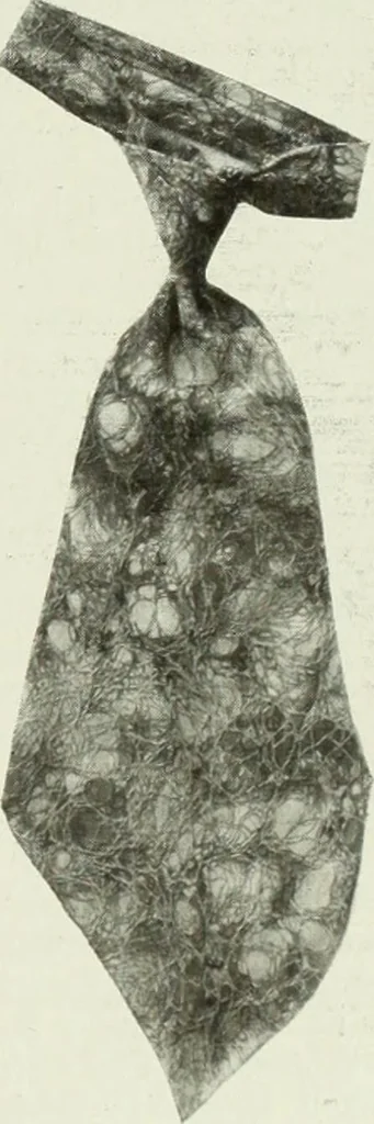 An illustration from Men's wear of Canada (January-December 1918), 1918, leaf 310
