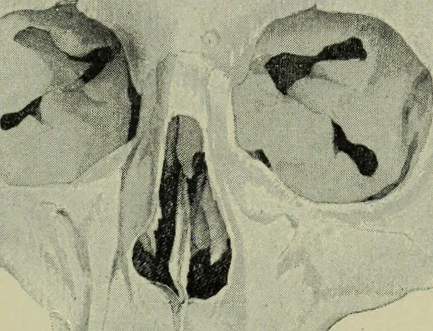 An illustration from The mental functions of the brain : an investigation into their localisation and their manifestation in health and disease, 1901, leaf 188