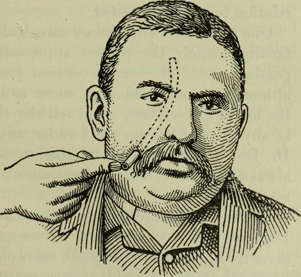 An illustration from The mental functions of the brain : an investigation into their localisation and their manifestation in health and disease, 1901, leaf 306
