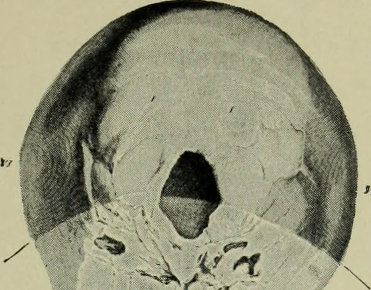 An illustration from The mental functions of the brain : an investigation into their localisation and their manifestation in health and disease, 1901, leaf 356