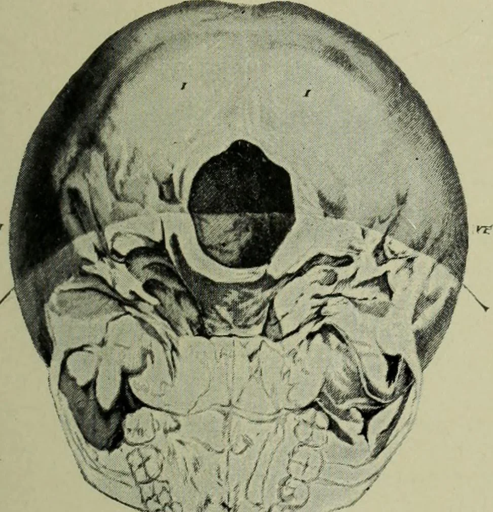 An illustration from The mental functions of the brain : an investigation into their localisation and their manifestation in health and disease, 1901, leaf 356