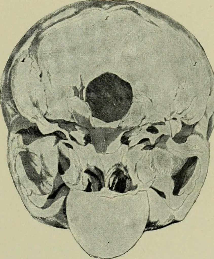 An illustration from The mental functions of the brain : an investigation into their localisation and their manifestation in health and disease, 1901, leaf 356