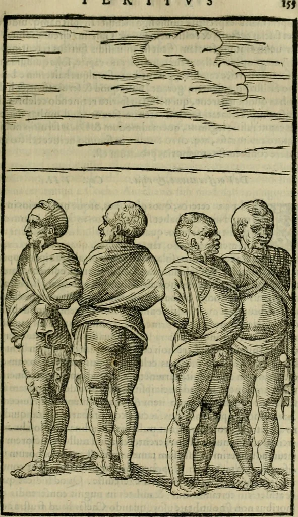 An illustration from Hieronymi Mercvrialis De arte gymnastica libri sex : in quibus exercitationum omnium vetustarum genera, loca, modi, facultates, & quidquid deniq. ad corporis humani exercitationes pertinet, diligenter explicatur .., 1573, leaf 174
