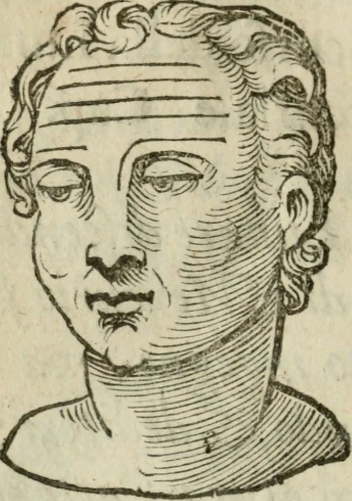 An illustration from La metoposcopia, ouero, Com[m]ensuratione delle linee della fronte : trattato, 1626, leaf 105