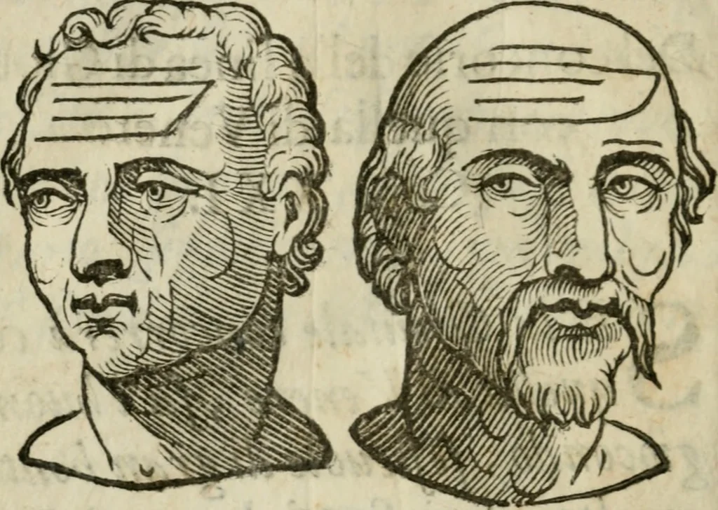An illustration from La metoposcopia, ouero, Com[m]ensuratione delle linee della fronte : trattato, 1626, leaf 117