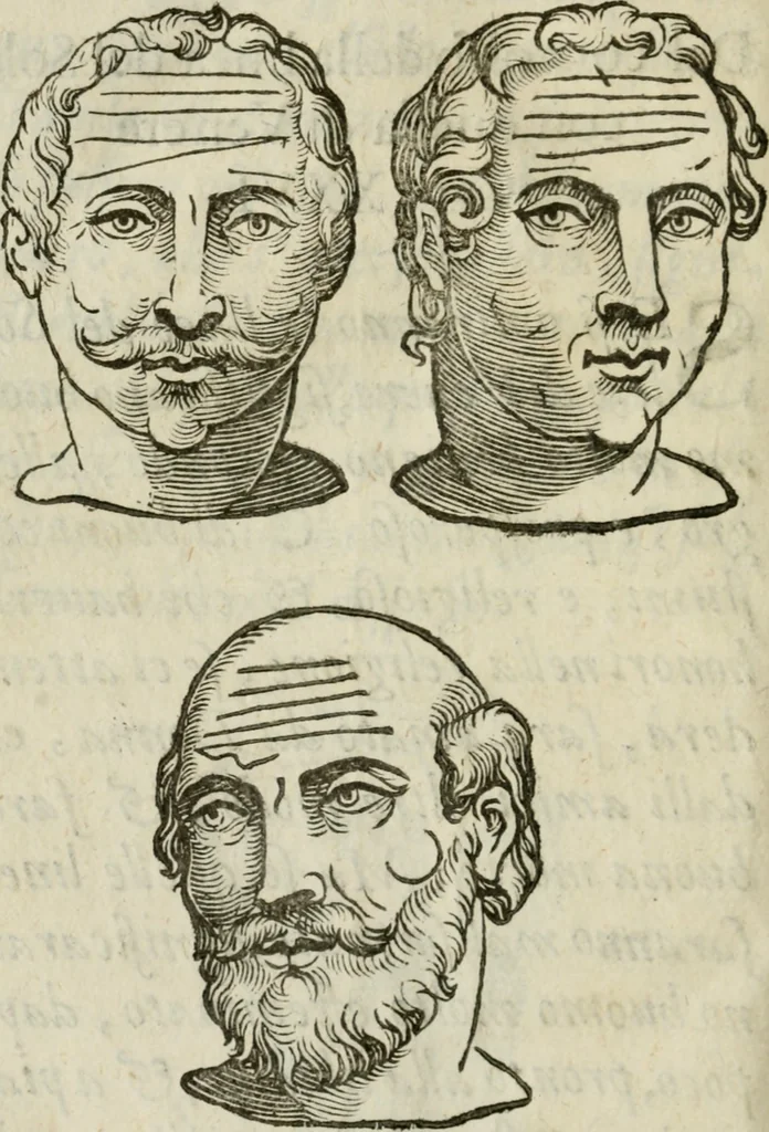 An illustration from La metoposcopia, ouero, Com[m]ensuratione delle linee della fronte : trattato, 1626, leaf 125