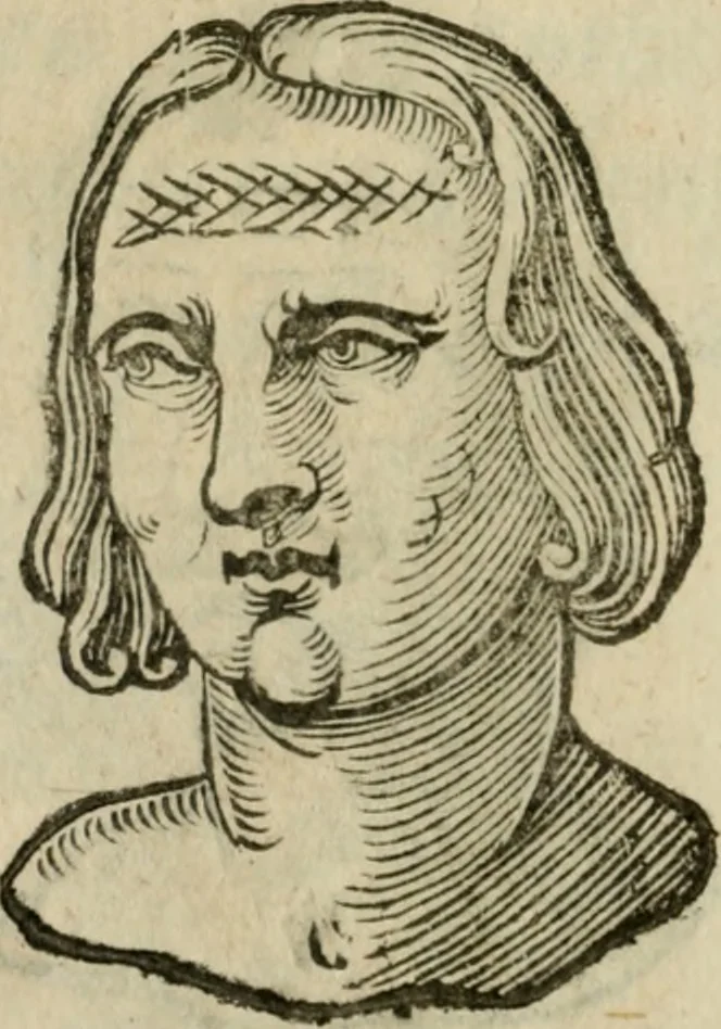 An illustration from La metoposcopia, ouero, Com[m]ensuratione delle linee della fronte : trattato, 1626, leaf 47